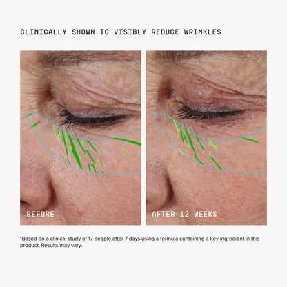 Mini Needle-less® Growth Factor Serum